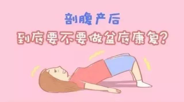 剖宮產(chǎn)媽媽要不要盆底康復(fù)？