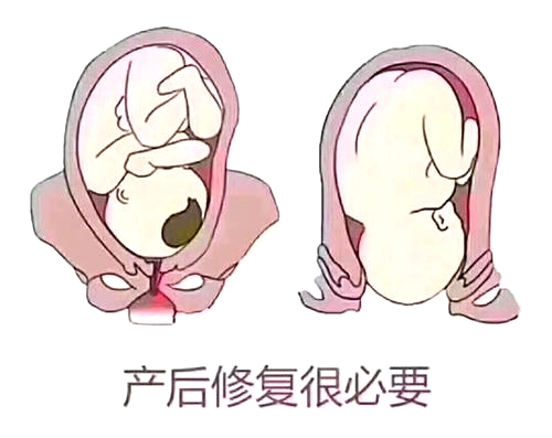產(chǎn)后恢復(fù)項(xiàng)目好不好，兩大指標(biāo)尤為關(guān)鍵