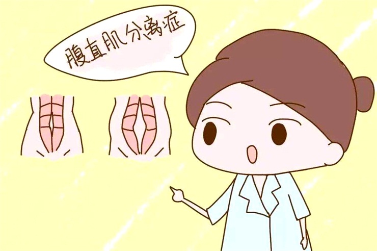 腹直肌分離問題，產(chǎn)后康復(fù)治療儀幫助您