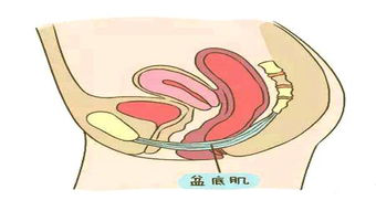 盆底肌康復(fù)治療儀，如何讓盆底肌康復(fù)評(píng)估報(bào)告更可靠