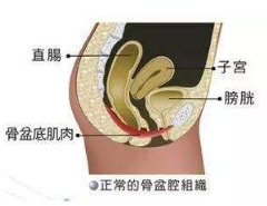 產(chǎn)后盆底肌怎么修復(fù)？你得做好盆底功能檢測