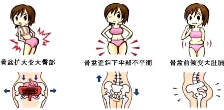 盆底康復(fù)治療怎么做，盆底治療儀是關(guān)鍵點(diǎn)